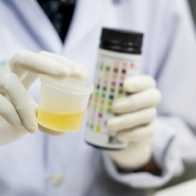 urine